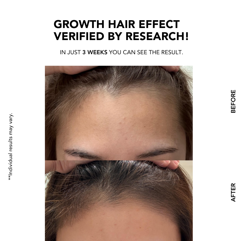Anti-Hair Loss Scalp Shampoo 300ml|Hair Growth|Anti Hair Loss|Hair Loss Control|Oily Scalp | 防脱控油洗发水 | 脱发 |掉发