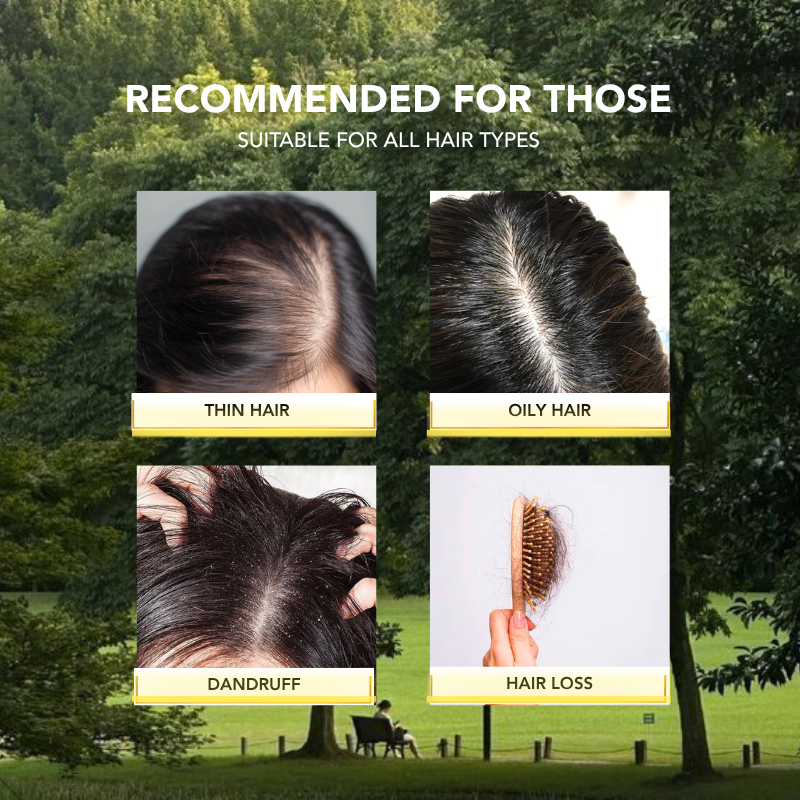 Anti-Hair Loss Scalp Shampoo 300ml|Hair Growth|Anti Hair Loss|Hair Loss Control|Oily Scalp | 防脱控油洗发水 | 脱发 |掉发