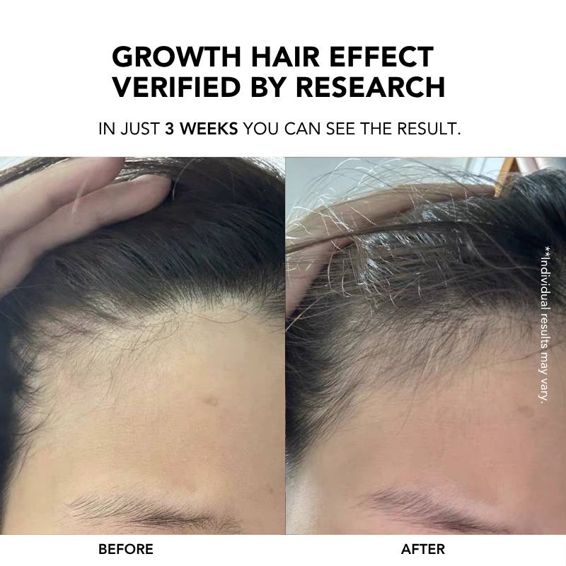 Root Enhancer Hair Tonic 100ml|Hair Growth Serum|Anti Hair Loss|Hair Loss Control|Hair Growth|Scalp Tonic 生发液