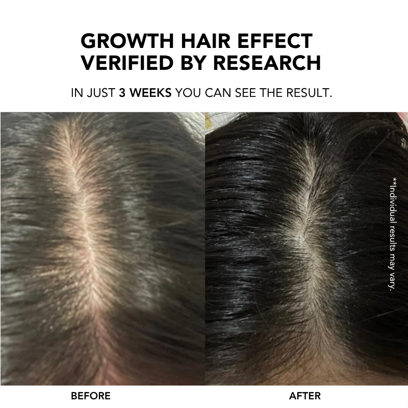 Root Enhancer Hair Tonic 100ml|Hair Growth Serum|Anti Hair Loss|Hair Loss Control|Hair Growth|Scalp Tonic 生发液