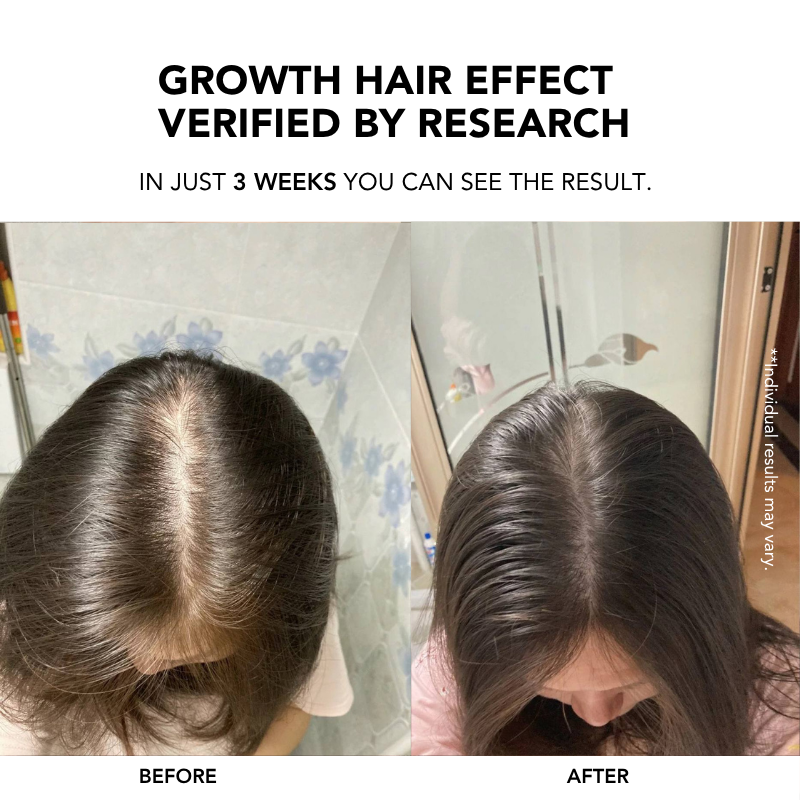 Root Enhancer Hair Tonic 100ml|Hair Growth Serum|Anti Hair Loss|Hair Loss Control|Hair Growth|Scalp Tonic 生发液