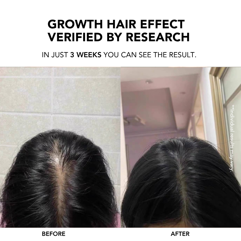 Root Enhancer Hair Tonic 100ml|Hair Growth Serum|Anti Hair Loss|Hair Loss Control|Hair Growth|Scalp Tonic 生发液
