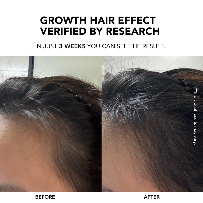 Root Enhancer Hair Tonic 100ml|Hair Growth Serum|Anti Hair Loss|Hair Loss Control|Hair Growth|Scalp Tonic 生发液